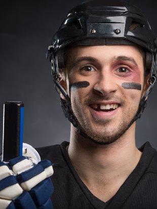 Professioneller Sportmundschutz aus Berlin-Lichterfelde – Optimaler Schutz für Zähne und Kiefer